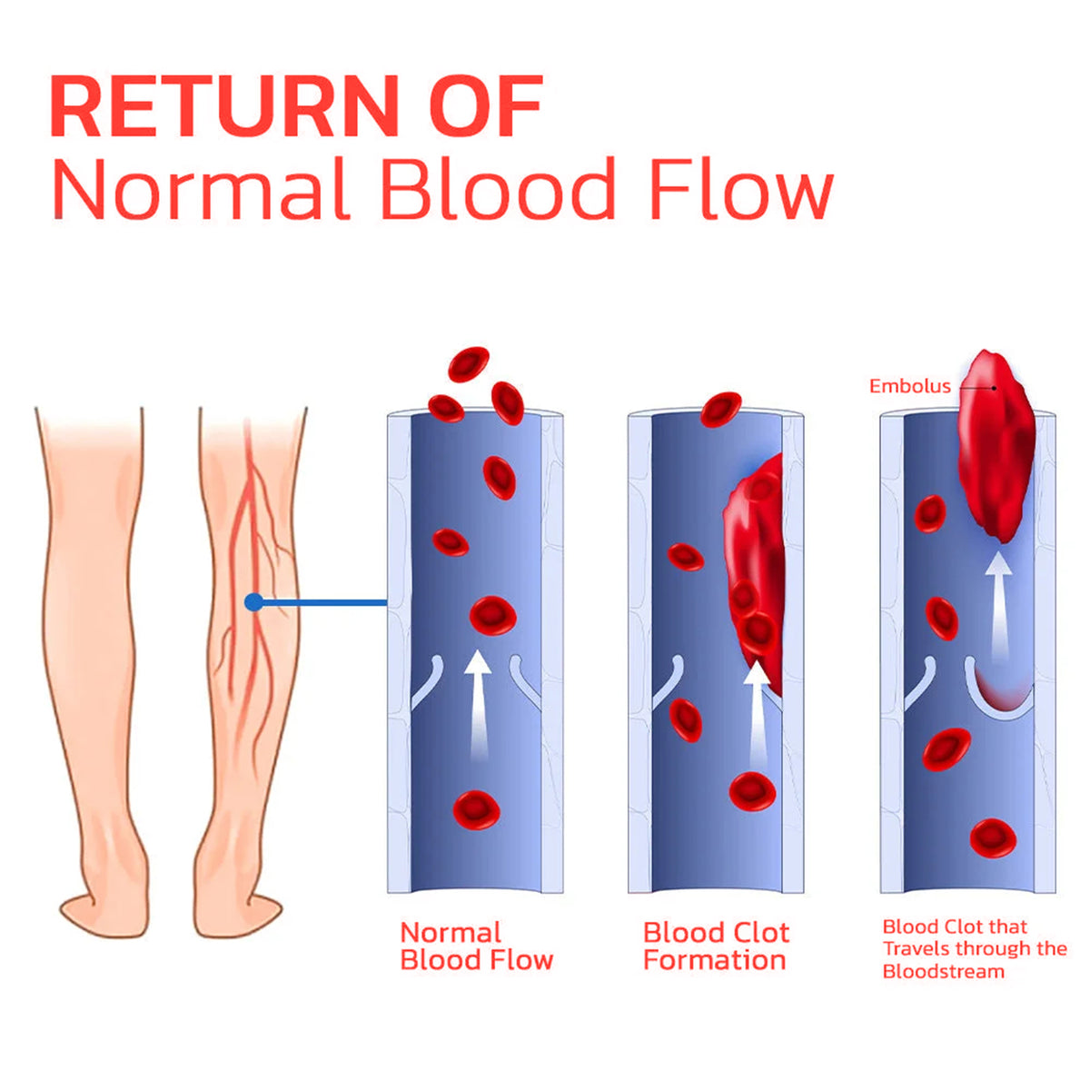 Far Infrared Tourmaline Acupressure Insoles.