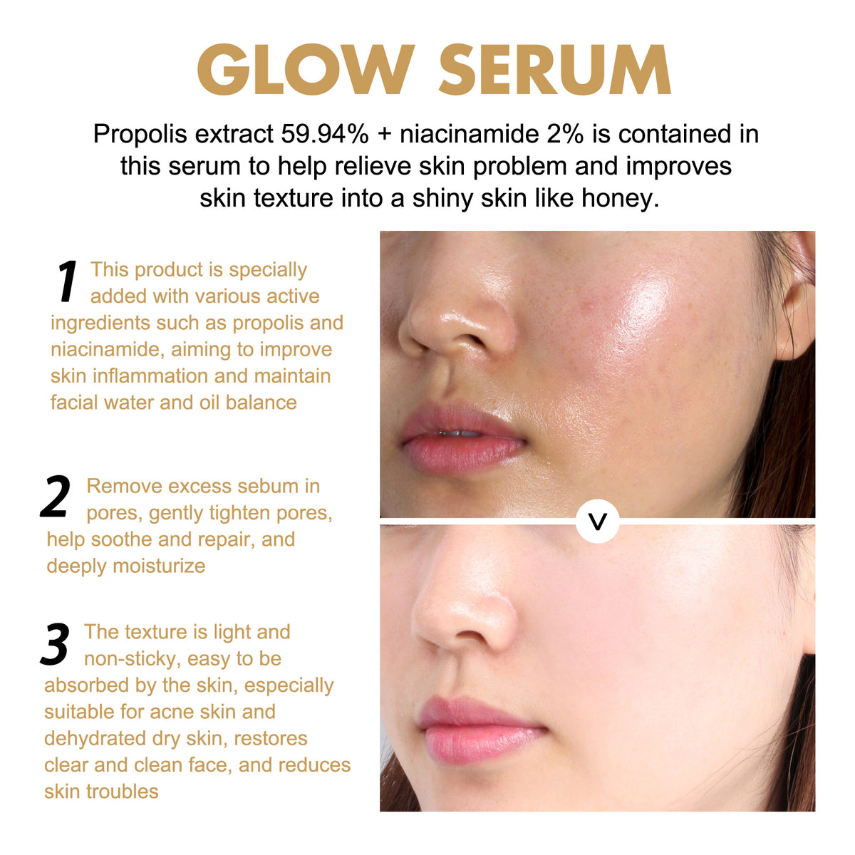 EELHOE Propolis Nicotinamide Photosensitive Essence, Reduces Acne Marks Moisturizes Brightens And Whitens Facial Essence