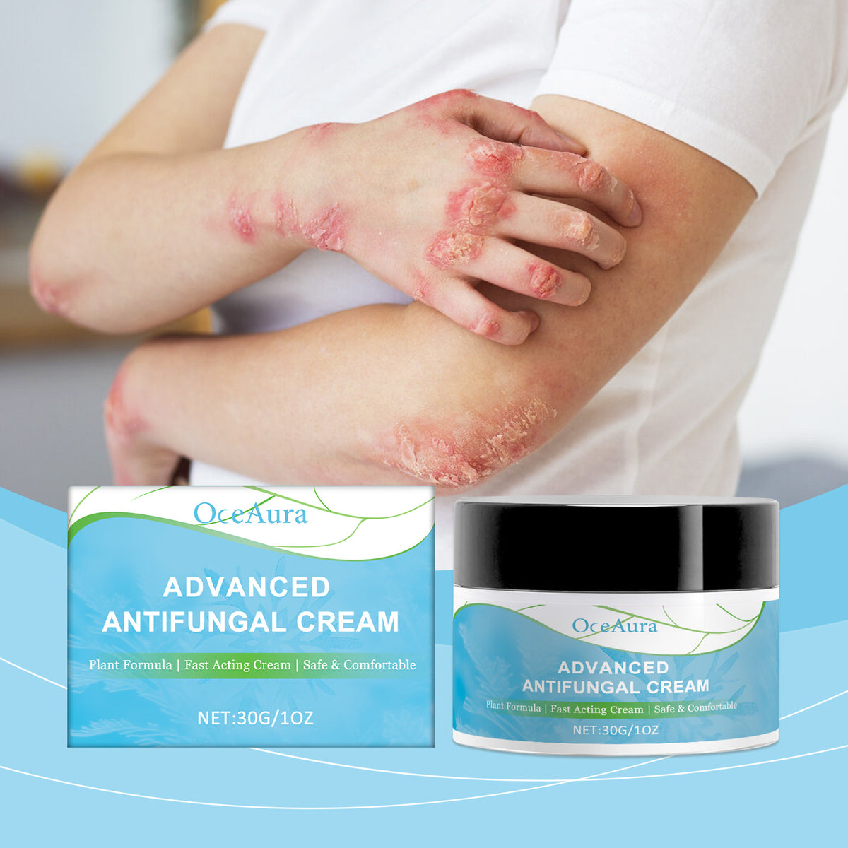 OceAura Skin Repair Cream shown beside its matching blue box, with a blue jar and black lid, above skin with red patches