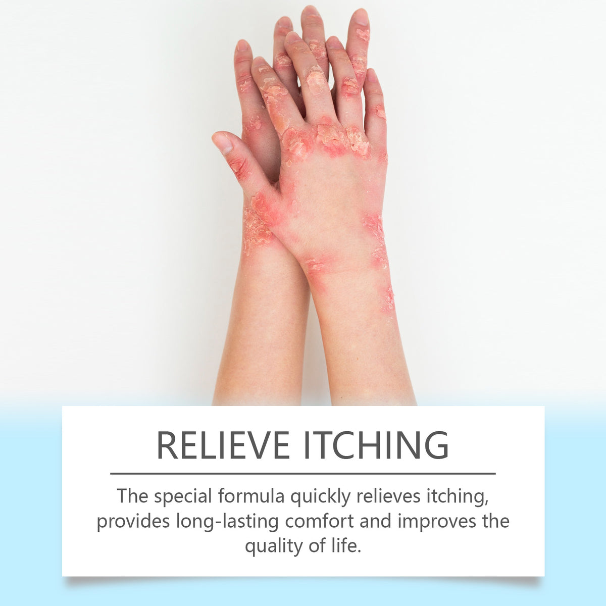 OceAura Skin Repair Cream shown with a relief-itching caption above two hands with red, flaky patches on a white background