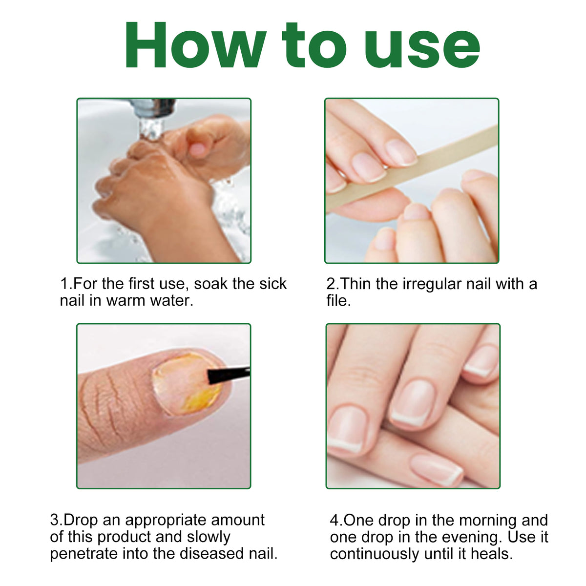 EELHOE Fungal Nail Renewal Treatment Serum – 30ml Antifungal Liquid.