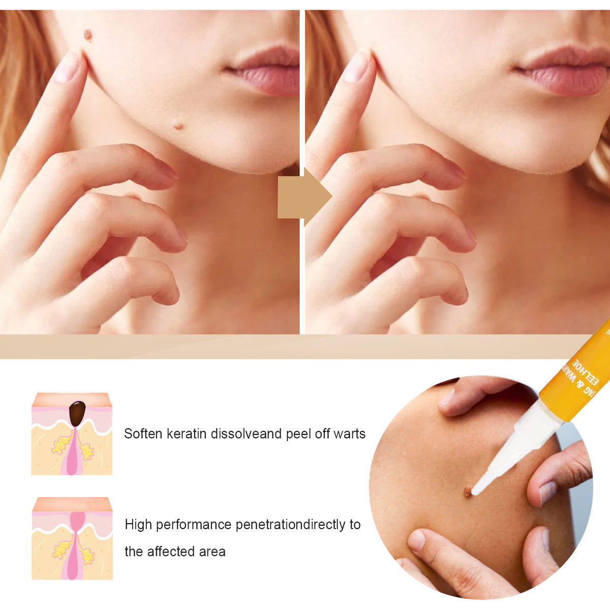 EELHOE Skin Repair Liquid Pen (1 Piece) Gently Repairs And Smooths Body Skin, Neck And Face Skin Care Pen
