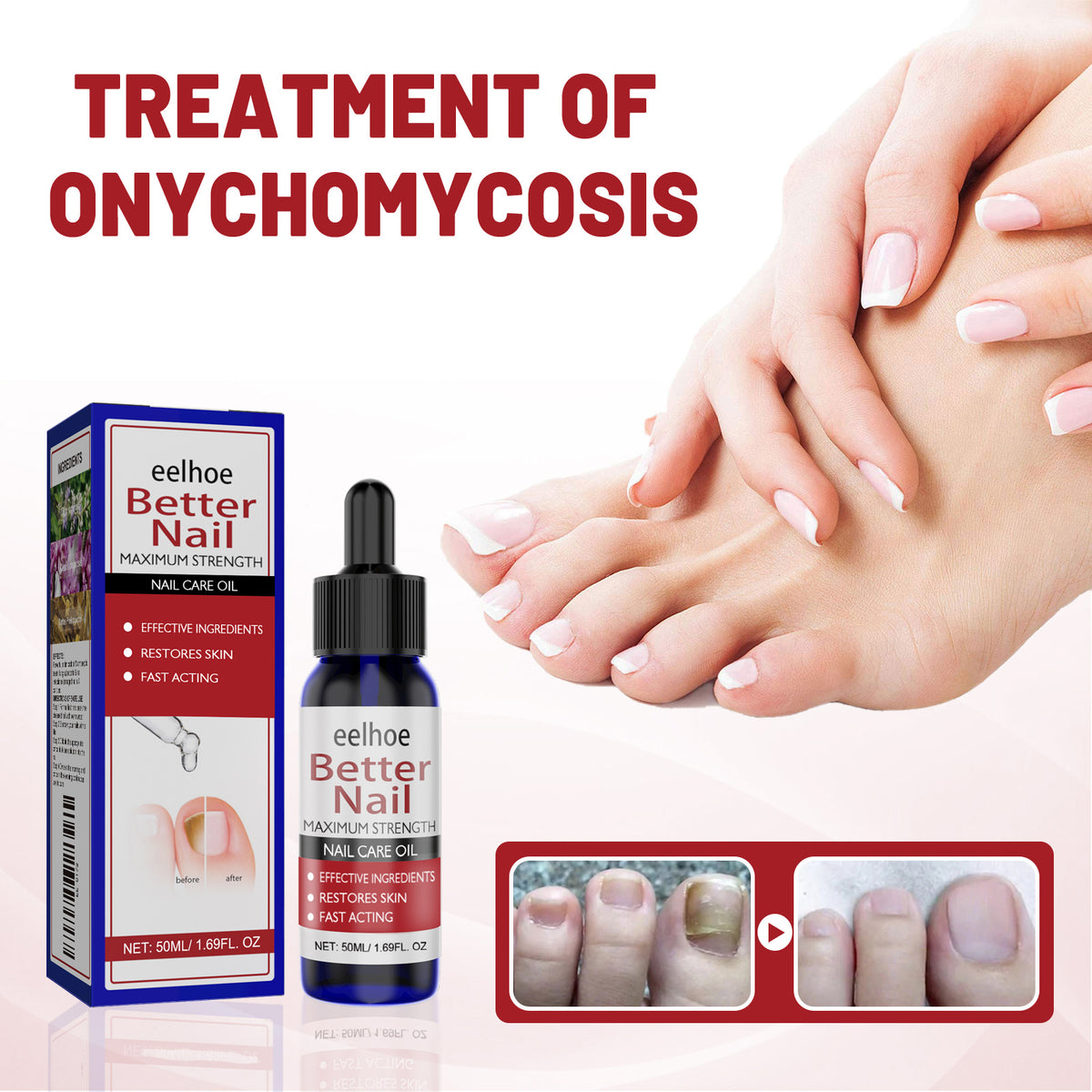 EELHOE Nail Repair Solution, Hands And Feet Nail Repair Moisturizing Clean And Remove Gray Nail Repair Solution