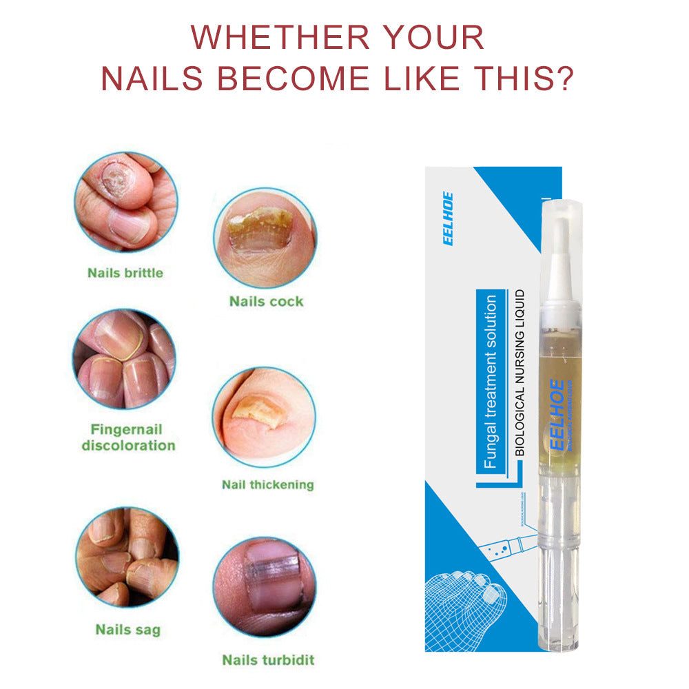 EELHOE Nail Care Solution Hand, Foot And Nail Care Clean Soft Nails Daily Gentle Moisturizing And Curing Polish Solution.